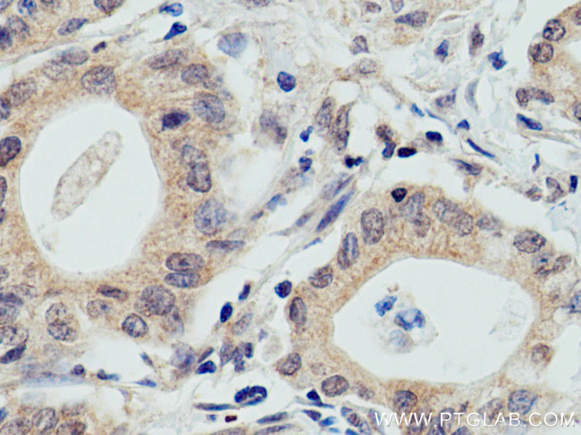 WWP2 Antibody in Immunohistochemistry (Paraffin) (IHC (P))