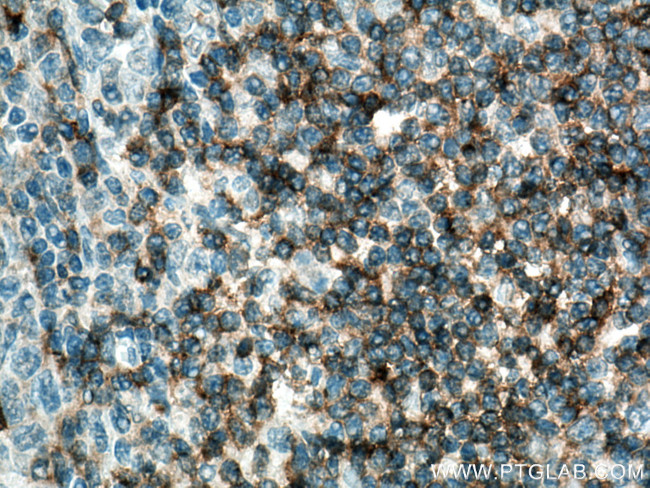 CD5 Antibody in Immunohistochemistry (Paraffin) (IHC (P))