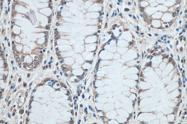 SNRPN Antibody in Immunohistochemistry (Paraffin) (IHC (P))