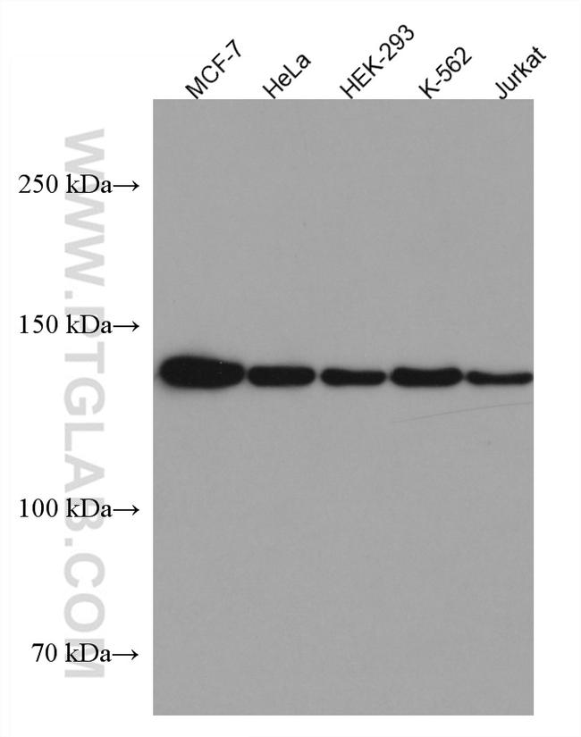 ALG13 Antibody in Western Blot (WB)