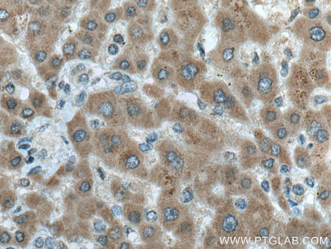 ERN2 Antibody in Immunohistochemistry (Paraffin) (IHC (P))