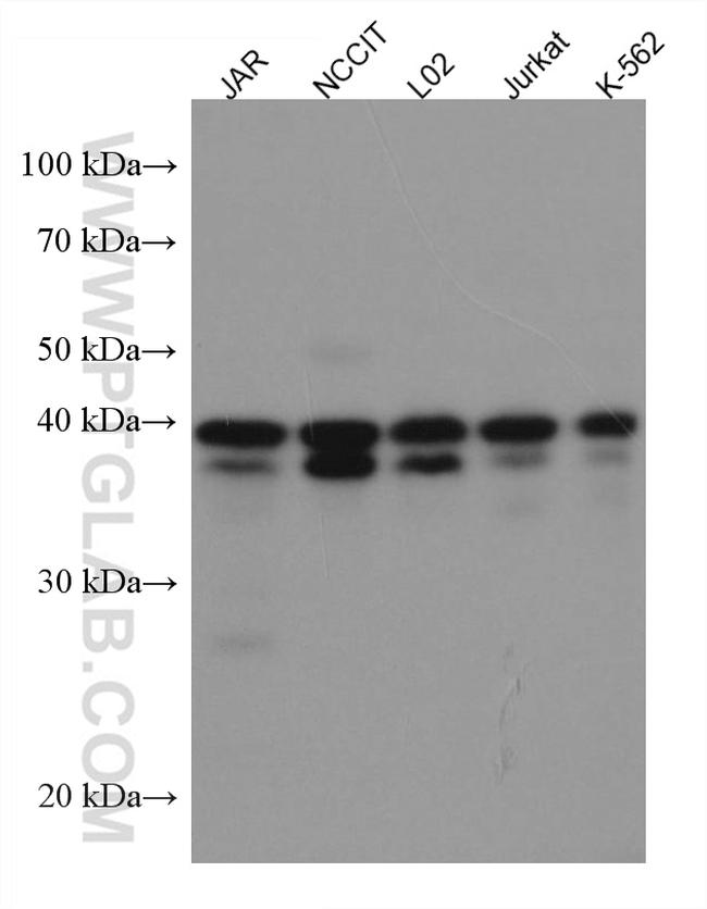 KLF6 Antibody in Western Blot (WB)