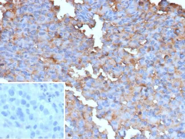 BRAF (V600E Mutant Specific) (Prognostic Marker) Antibody in Immunohistochemistry (Paraffin) (IHC (P))