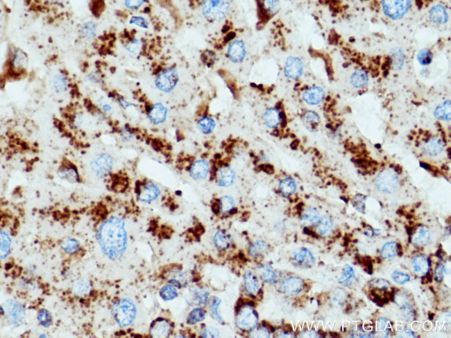 CD107a Antibody in Immunohistochemistry (Paraffin) (IHC (P))