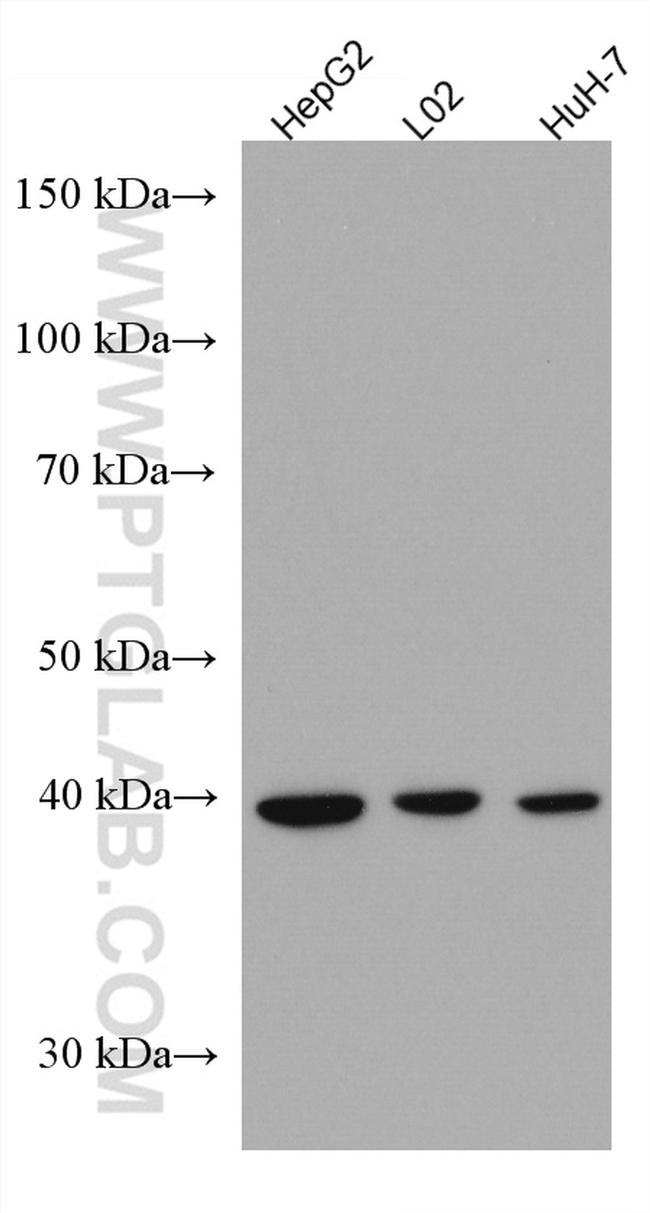 ADH4 Antibody in Western Blot (WB)