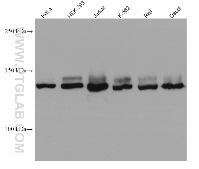 FANCI Antibody in Western Blot (WB)
