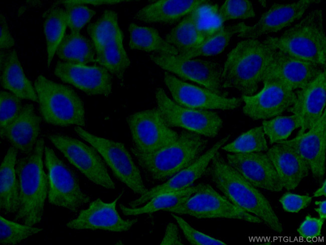 Alpha 2-Antiplasmin Antibody in Immunocytochemistry (ICC/IF)