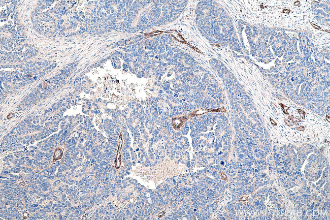 Entactin Antibody in Immunohistochemistry (Paraffin) (IHC (P))
