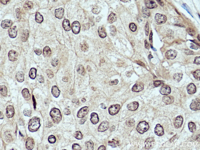 DCPS Antibody in Immunohistochemistry (Paraffin) (IHC (P))