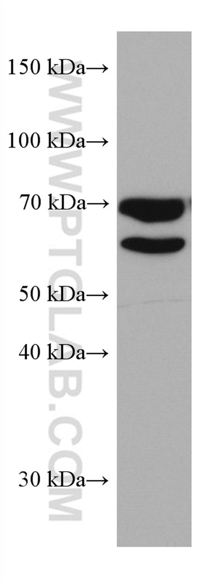 MTMR2 Antibody in Western Blot (WB)
