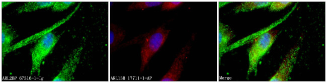 ARL2BP Antibody in Immunocytochemistry (ICC/IF)