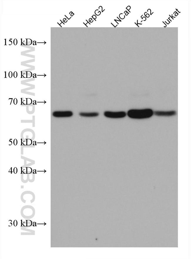 UBP1 Antibody in Western Blot (WB)