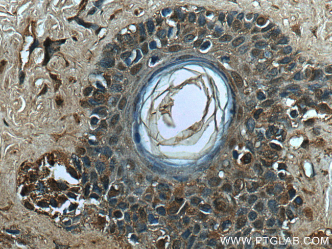 TFE3 Antibody in Immunohistochemistry (Paraffin) (IHC (P))