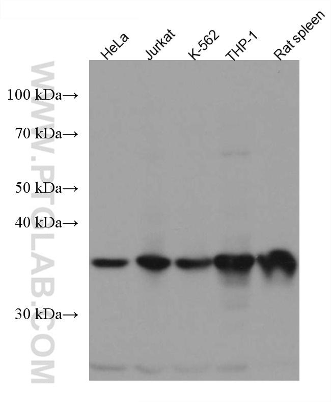 ARPC1B Antibody in Western Blot (WB)