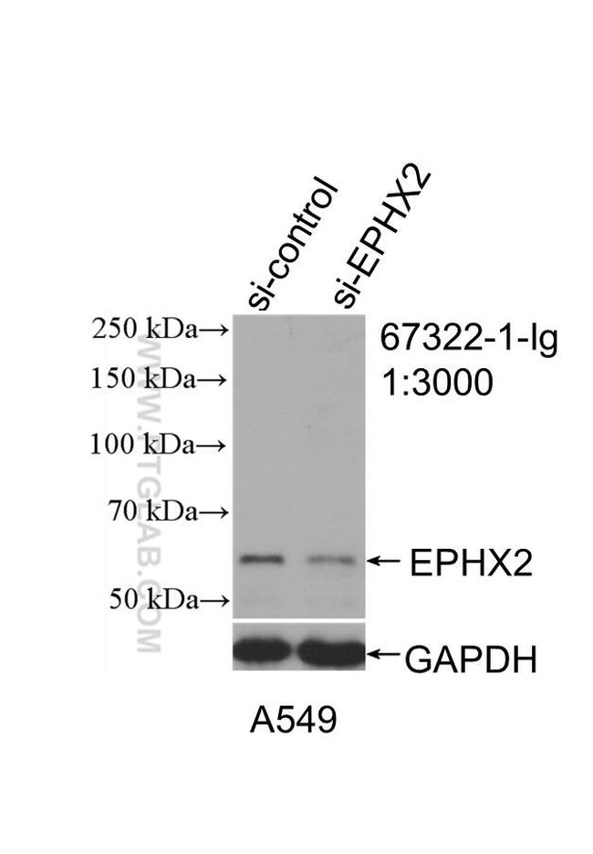EPHX2 Antibody in Western Blot (WB)