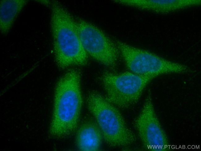 LAMR1/RPSA Antibody in Immunocytochemistry (ICC/IF)