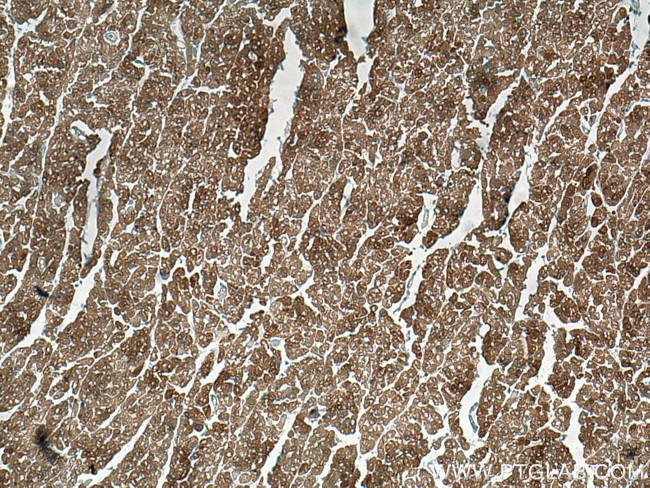 HSP20 Antibody in Immunohistochemistry (Paraffin) (IHC (P))