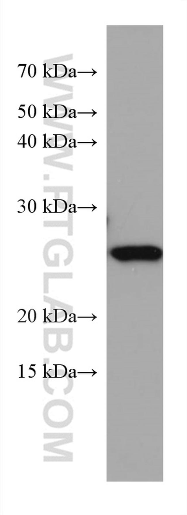 NICN1 Antibody in Western Blot (WB)