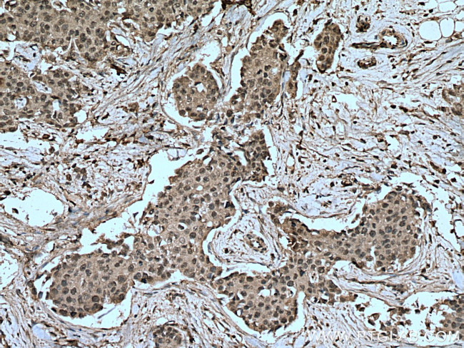 MAP2K4 Antibody in Immunohistochemistry (Paraffin) (IHC (P))