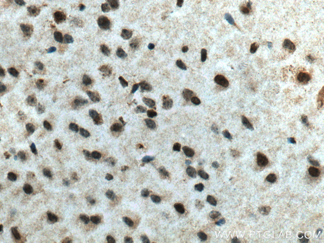RCC1 Antibody in Immunohistochemistry (Paraffin) (IHC (P))
