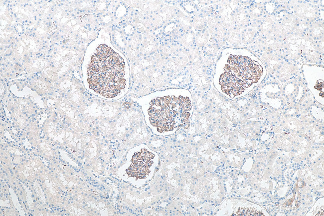SYNPO Antibody in Immunohistochemistry (Paraffin) (IHC (P))