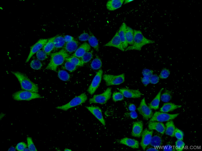 ATG7 Antibody in Immunocytochemistry (ICC/IF)