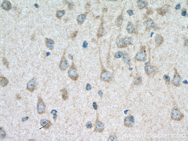 TRIM2 Antibody in Immunohistochemistry (Paraffin) (IHC (P))