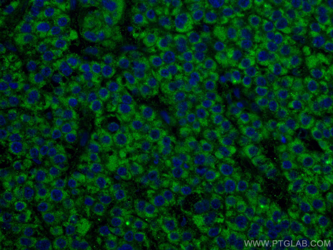 ALDH5A1 Antibody in Immunohistochemistry (Paraffin) (IHC (P))