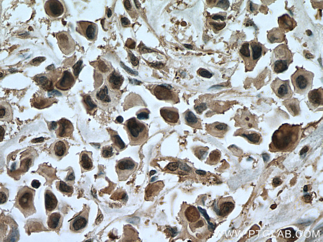 ANAPC5 Antibody in Immunohistochemistry (Paraffin) (IHC (P))