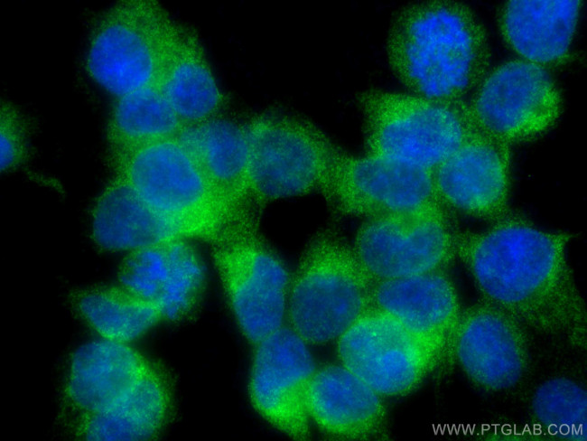 SEC63 Antibody in Immunocytochemistry (ICC/IF)