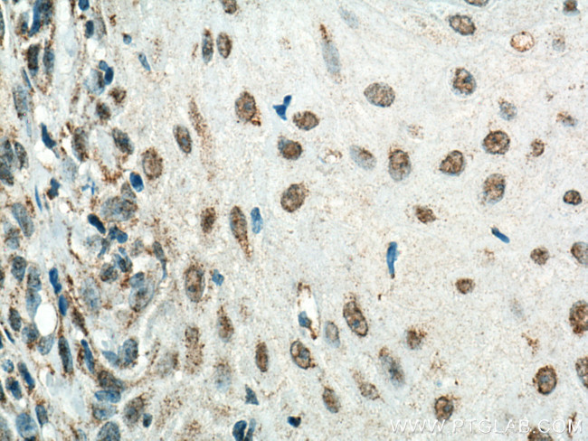HMG20B Antibody in Immunohistochemistry (Paraffin) (IHC (P))