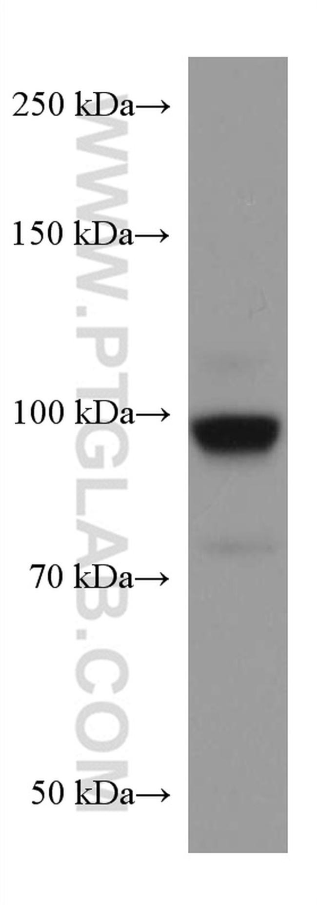 RALBP1 Antibody in Western Blot (WB)