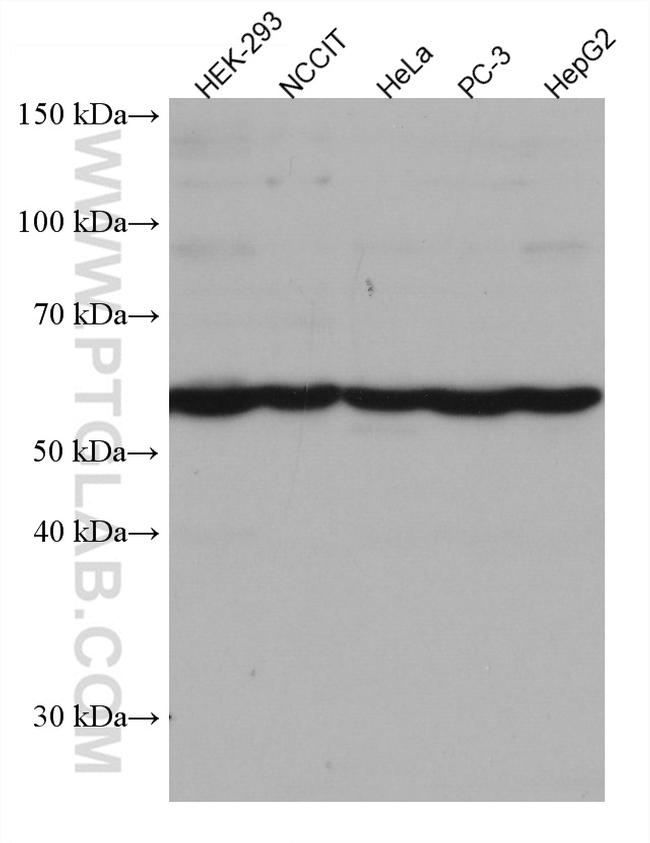 SPAST Antibody in Western Blot (WB)