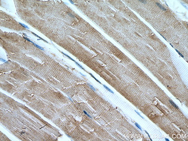 CAPN3 Antibody in Immunohistochemistry (Paraffin) (IHC (P))