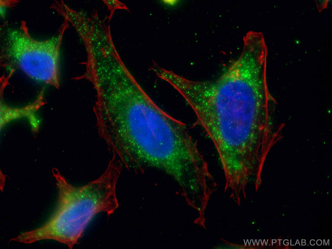 PNPLA3 Antibody in Immunocytochemistry (ICC/IF)