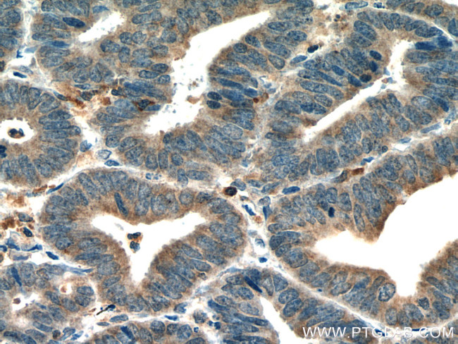 HOMER2 Antibody in Immunohistochemistry (Paraffin) (IHC (P))