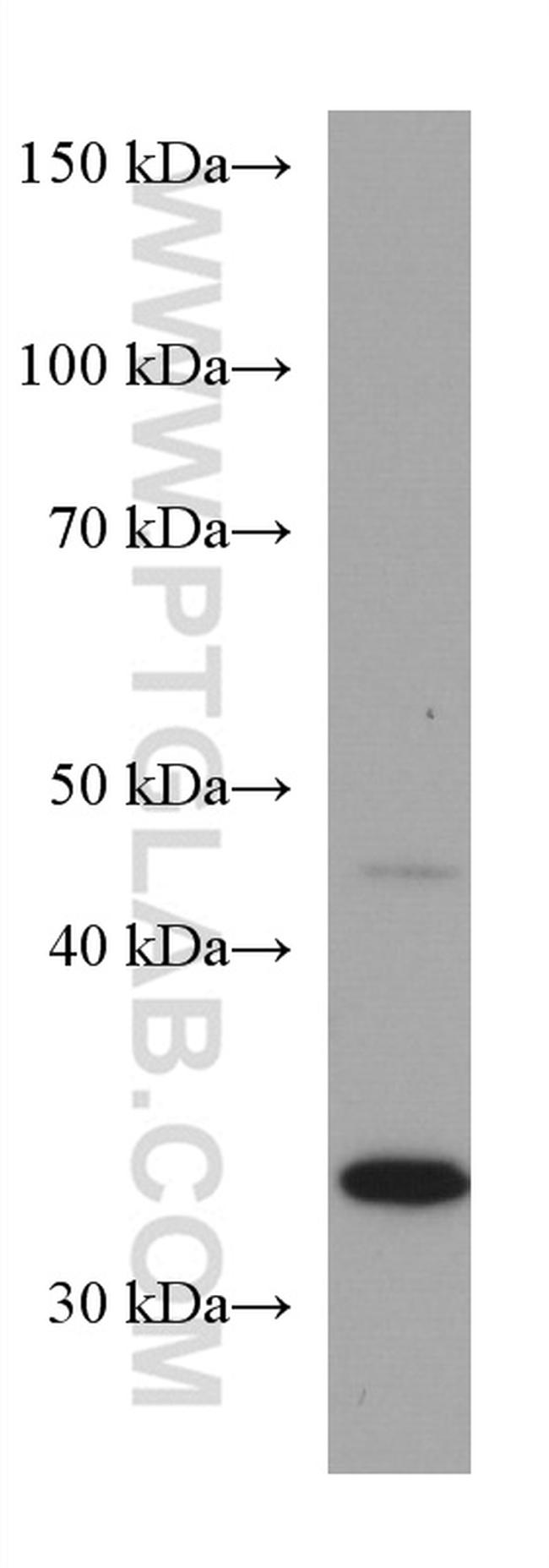 TUSC3 Antibody in Western Blot (WB)