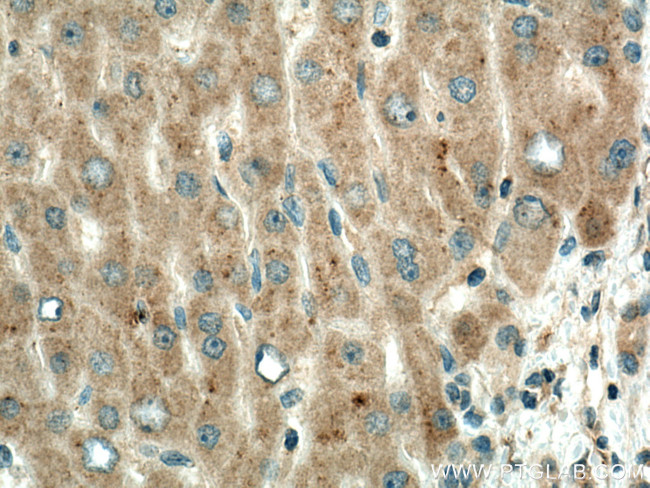 PPP4R1 Antibody in Immunohistochemistry (Paraffin) (IHC (P))