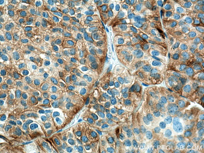 Secretogranin V Antibody in Immunohistochemistry (Paraffin) (IHC (P))