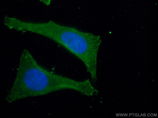 SEC24D Antibody in Immunocytochemistry (ICC/IF)