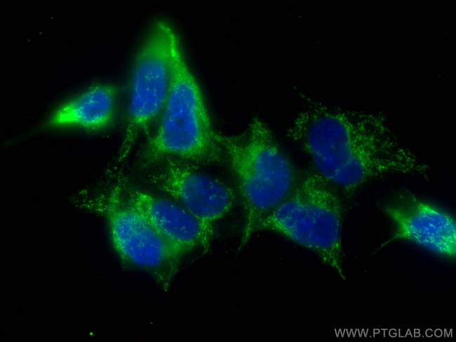 ERO1L Antibody in Immunocytochemistry (ICC/IF)
