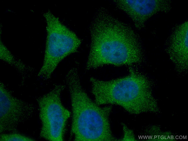 CDCA5 Antibody in Immunocytochemistry (ICC/IF)
