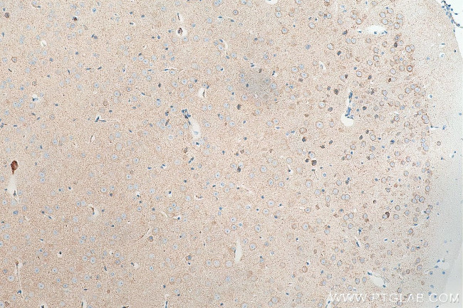 MAP1B Antibody in Immunohistochemistry (Paraffin) (IHC (P))