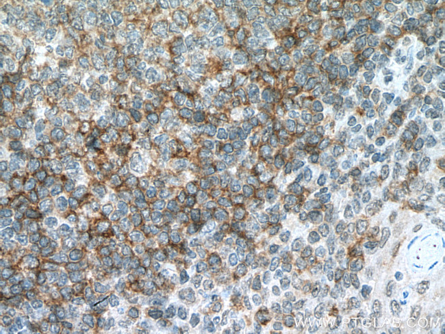 CD72 Antibody in Immunohistochemistry (Paraffin) (IHC (P))