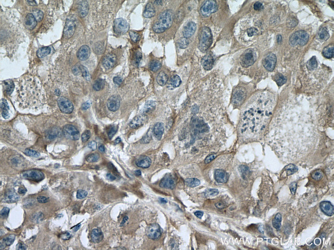 TTPA Antibody in Immunohistochemistry (Paraffin) (IHC (P))