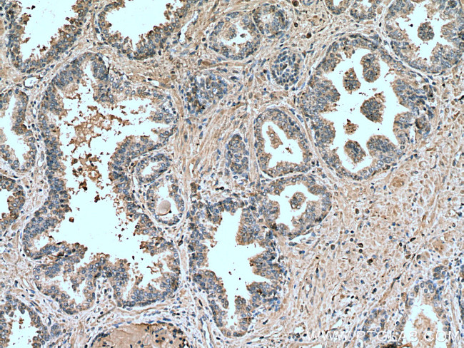 LIPG Antibody in Immunohistochemistry (Paraffin) (IHC (P))
