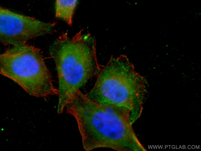 PPM1D Antibody in Immunocytochemistry (ICC/IF)