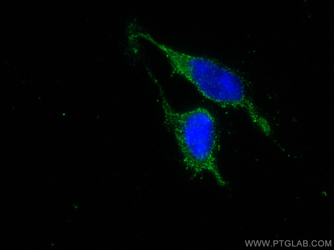 MESDC2 Antibody in Immunocytochemistry (ICC/IF)