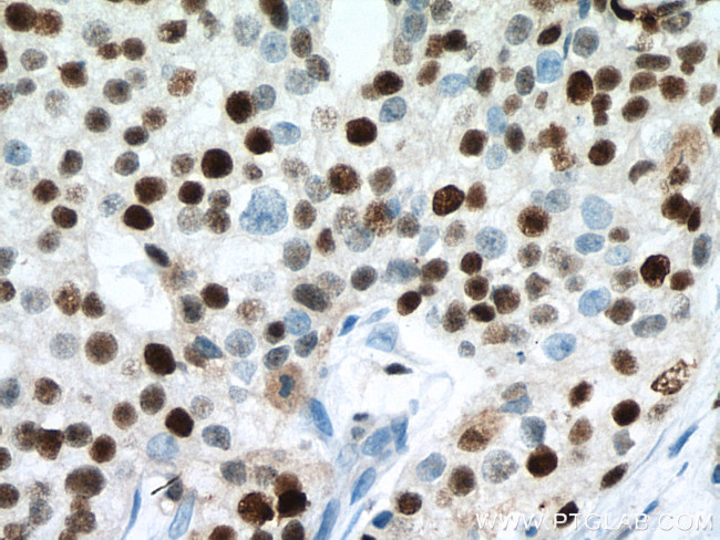 MCM7 Antibody in Immunohistochemistry (Paraffin) (IHC (P))