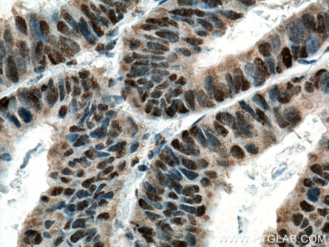 c-MYC Antibody in Immunohistochemistry (Paraffin) (IHC (P))
